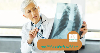 سنجش تراکم استخوان