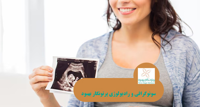 آمادگی های لازم قبل از انجام سونوگرافی بارداری 