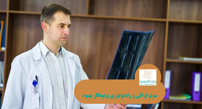 نقش وراثت و ژنتیک در پوکی استخوان